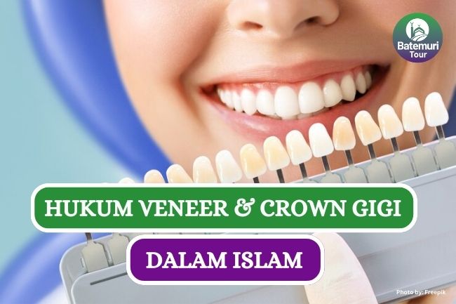 Hukum Veneer dan Crown Gigi dalam Islam, Apakah Boleh??